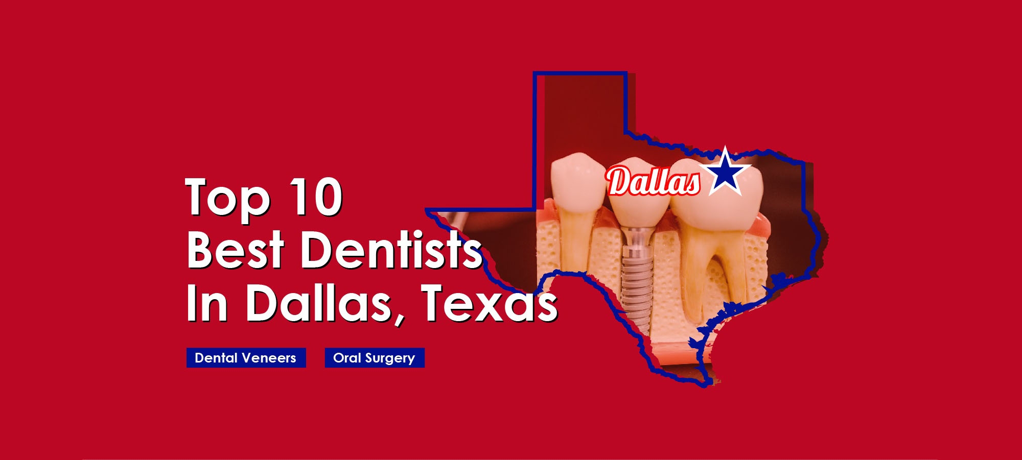 Top 10 Best Dentists Dallas